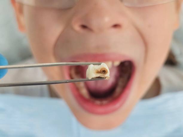 Best Knocked-Out Tooth Emergency  in West Glens Falls, NY