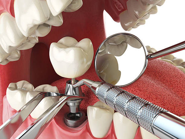 Best Dentist for Severe Toothache  in West Glens Falls, NY